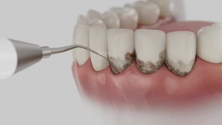 Trusted Dental Crowns And Bridges service in Gambrills, MD - Dentist Open Now